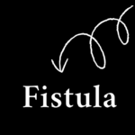 fistula