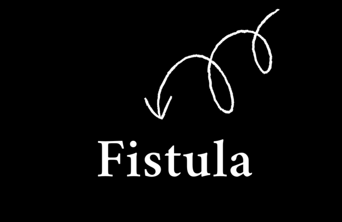 fistula