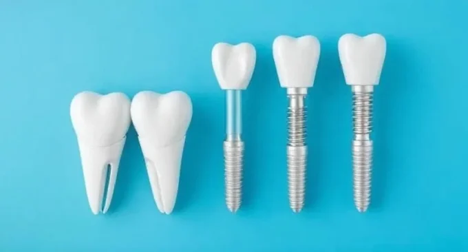 dental implants abroad helvetic clinics